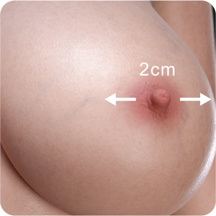 2cm